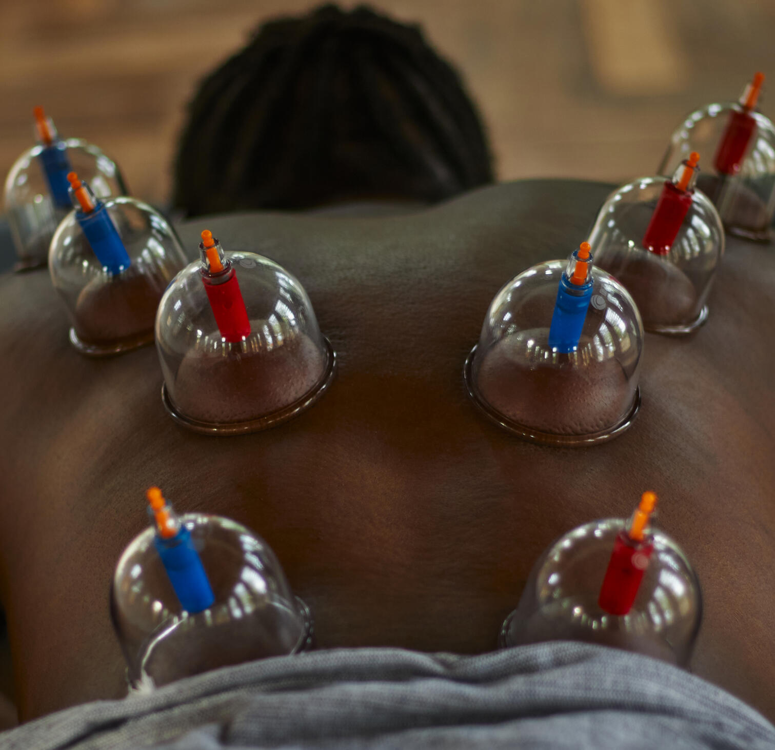 Dry Cupping